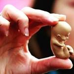 Sobre o aborto...(da democracia!)
