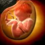 Aborto x Direito