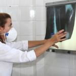 Ministério da Saúde ignora índices de tuberculose e ameaça tratamento