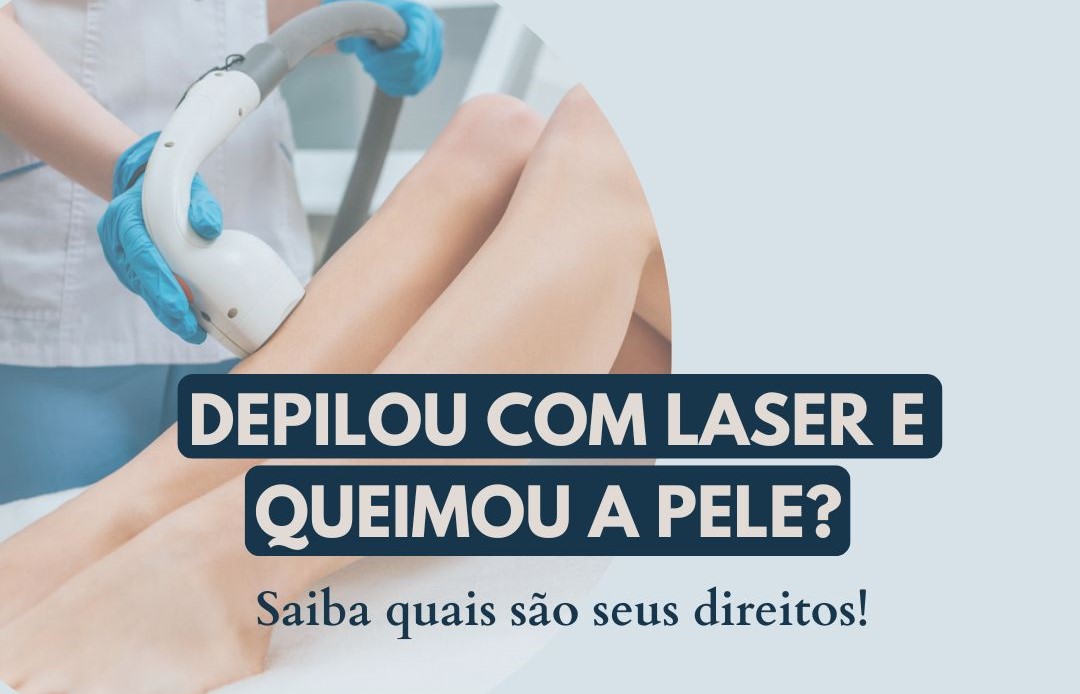 Indenização por Queimaduras na Pele após Depilação a Laser | Jusbrasil